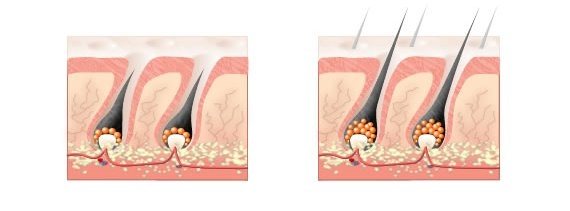 Как действует лимонное масло на волосы