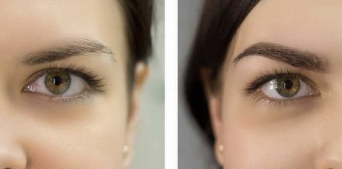 Ламинирование — это покрытие бровей оздоравливающим средством с сопутствующей коррекцией их формы и цвета