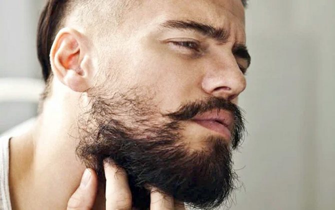 Месячная борода у мужчины