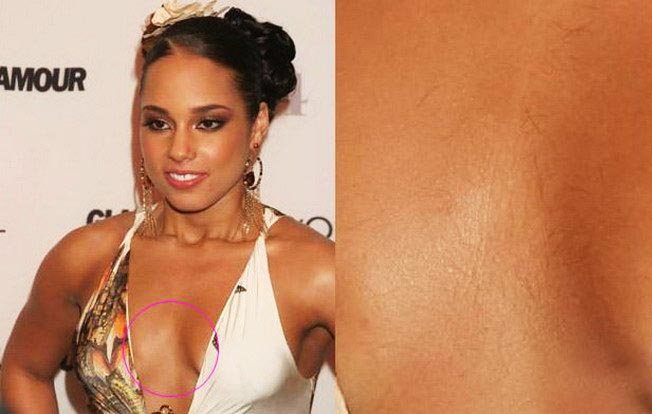 Волосы на груди у девушки, вокруг ореолы, сосков. Норма, анализы, к какому врачу обратиться