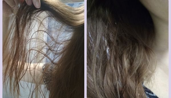 волосы жирные у корней и сухие на кончиках